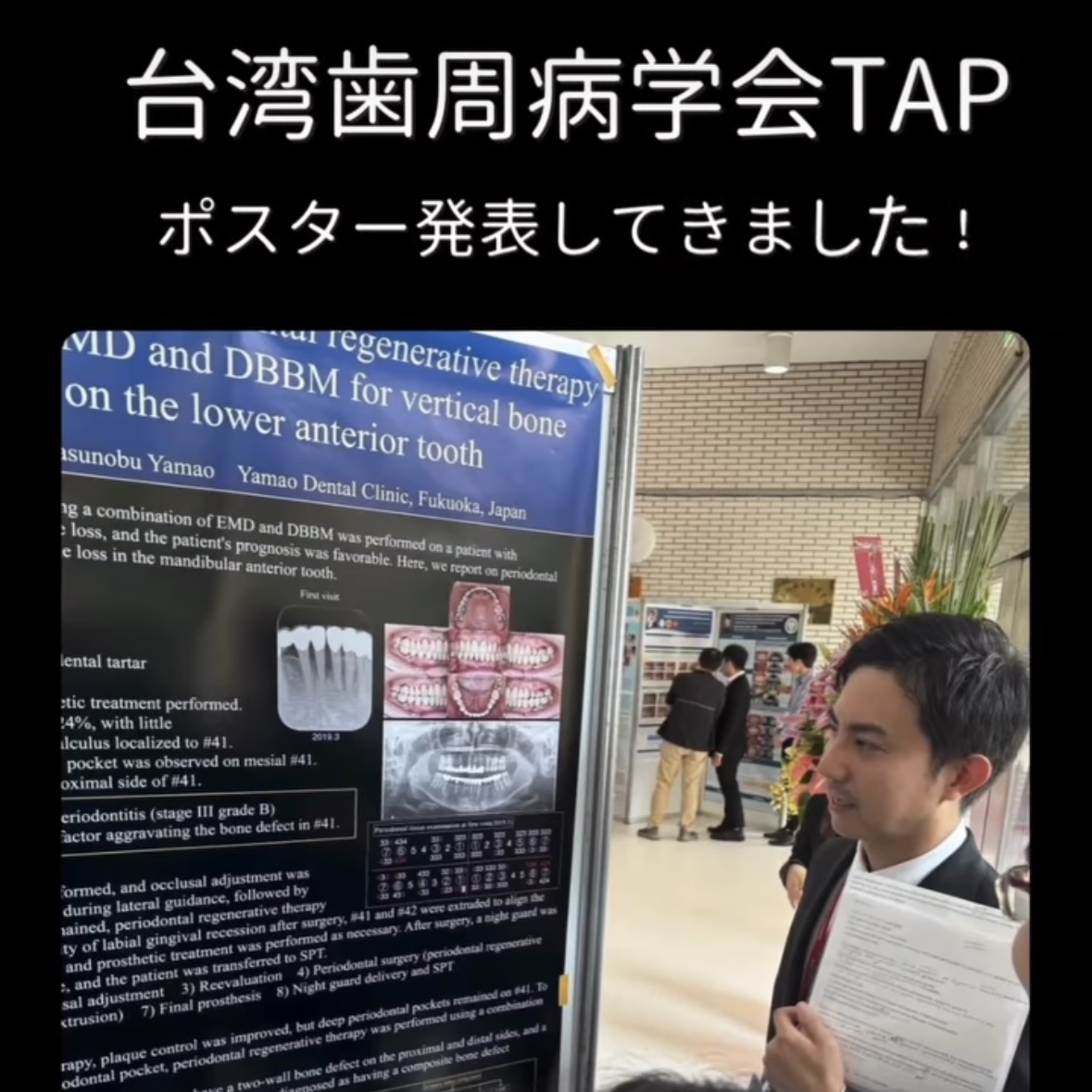 2024年10月 台湾臨床歯周病学会にてポスター発表を行いました