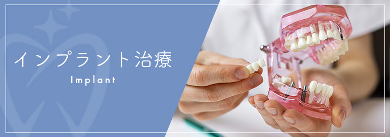 インプラント治療